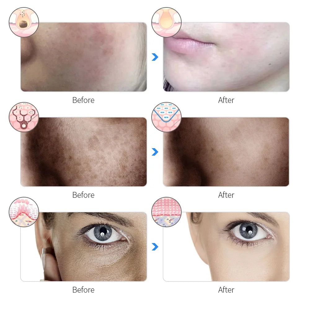 Wireless 7 Colors Light Led Facial Skincare Mask
