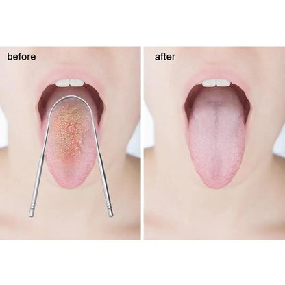 Stainless Tongue Scraper Cleaner