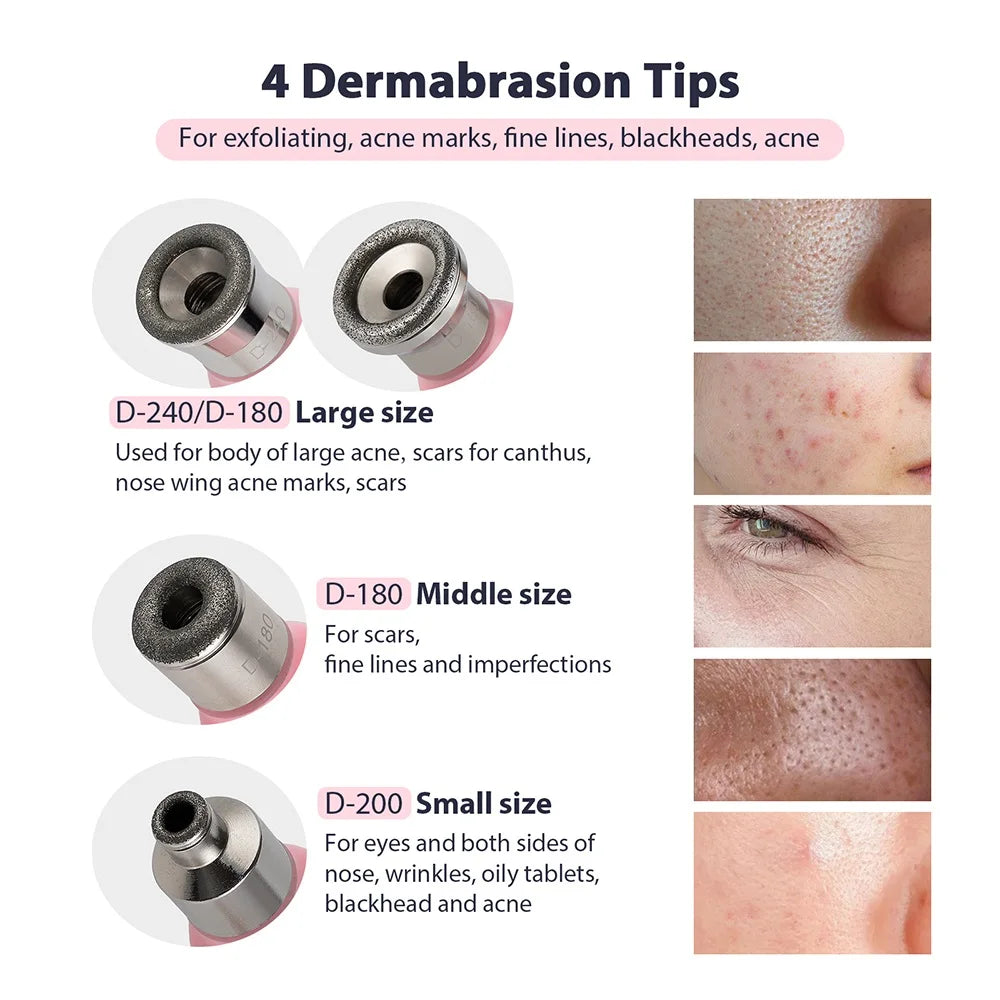 Portable Diamond Microdermabrasion Pen
